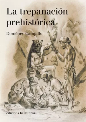 TREPANACION PREHISTORICA,LA